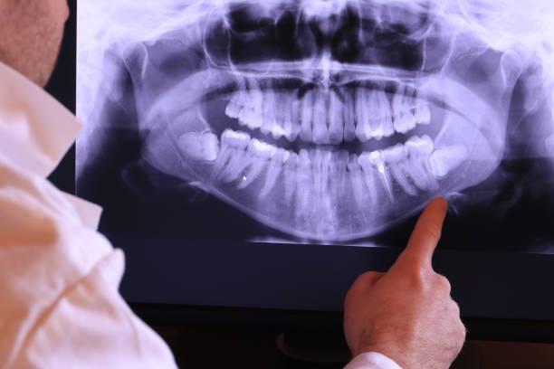 Best Emergency Root Canal Treatment in Central, SC